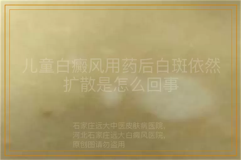 儿童白癜风用药后白斑依然扩散是怎么回事