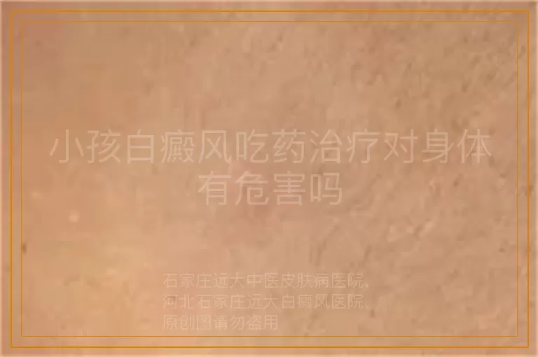 小孩白癜风吃药治疗对身体有危害吗