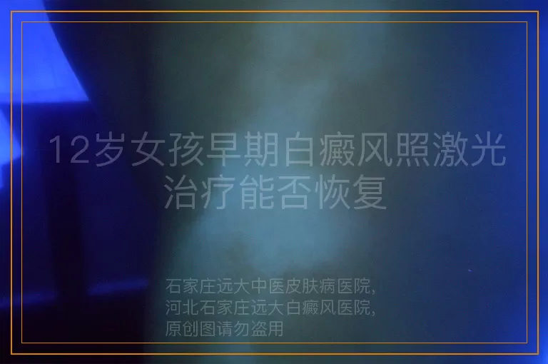 12岁女孩早期白癜风照激光治疗能否恢复
