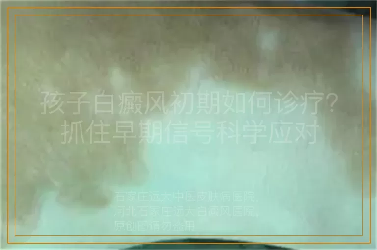 孩子白癜风初期如何诊疗？抓住早期信号科学应对