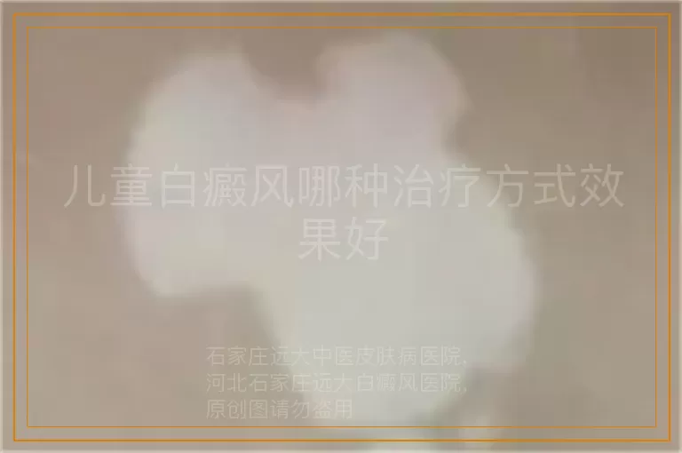 儿童白癜风哪种治疗方式效果好