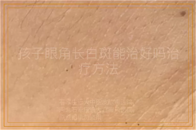 孩子眼角长白斑能治好吗治疗方法