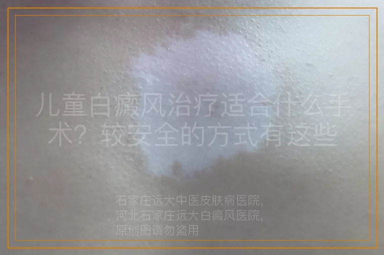 儿童白癜风治疗适合什么手术？较安全的方式有这些