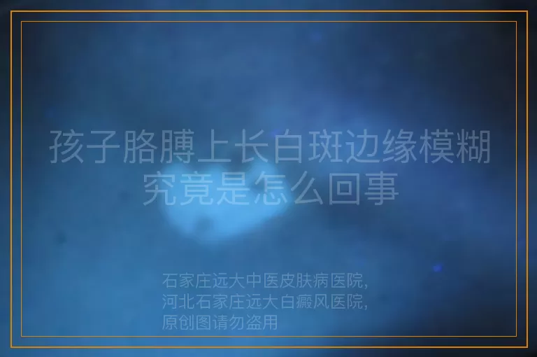 孩子胳膊上长白斑边缘模糊究竟是怎么回事
