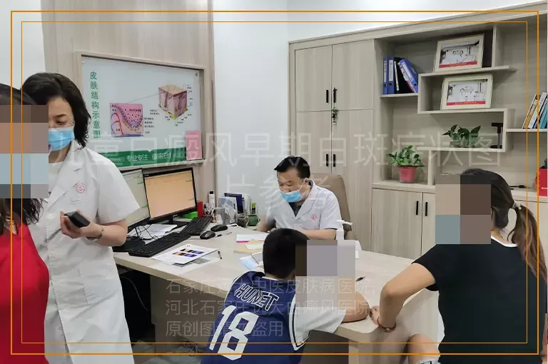 儿童白癜风早期白斑症状图片参考