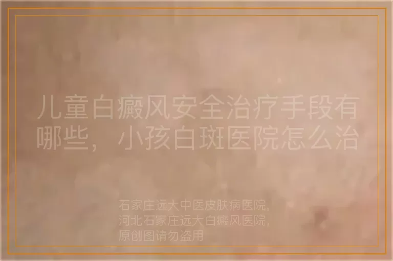 儿童白癜风安全治疗手段有哪些，小孩白斑医院怎么治安全，孩子患上白癜风如何安全治疗