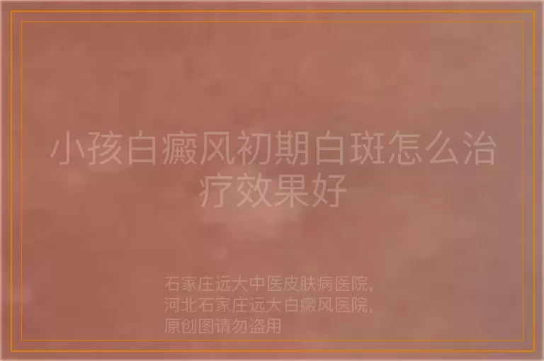 小孩白癜风初期白斑怎么治疗效果好
