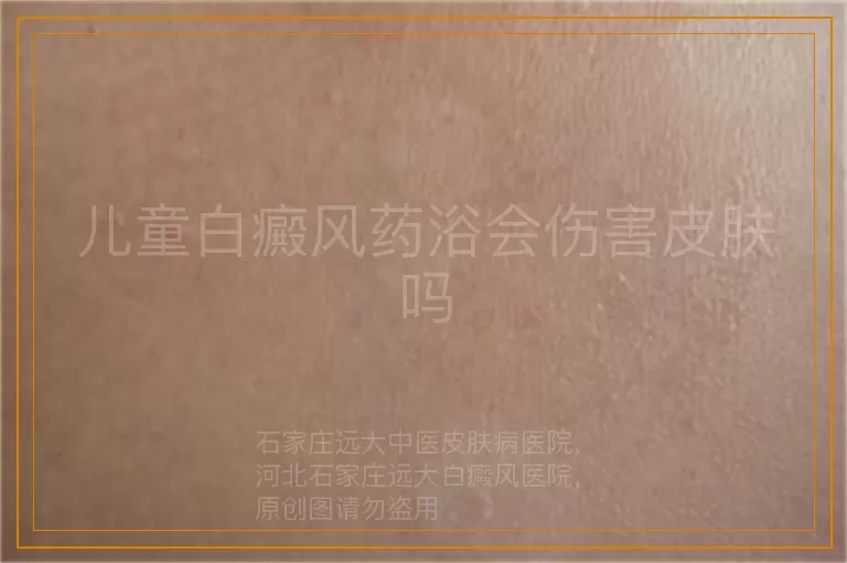 儿童白癜风药浴会伤害皮肤吗