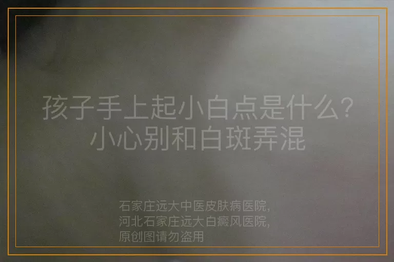 孩子手上起小白点是什么？小心别和白斑弄混