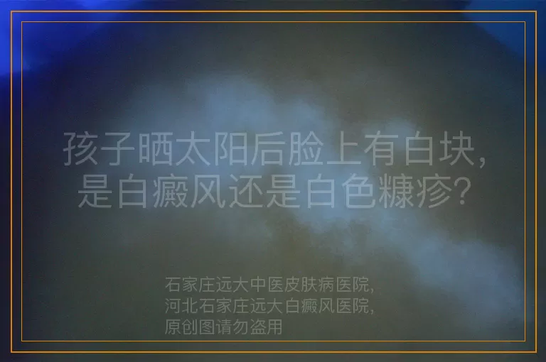 孩子晒太阳后脸上有白块，是白癜风还是白色糠疹？