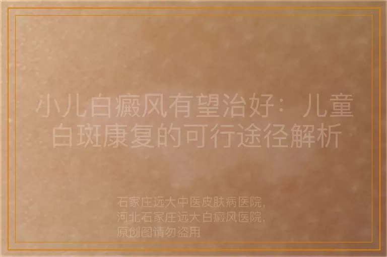 小儿白癜风有望治好：儿童白斑康复的可行途径解析