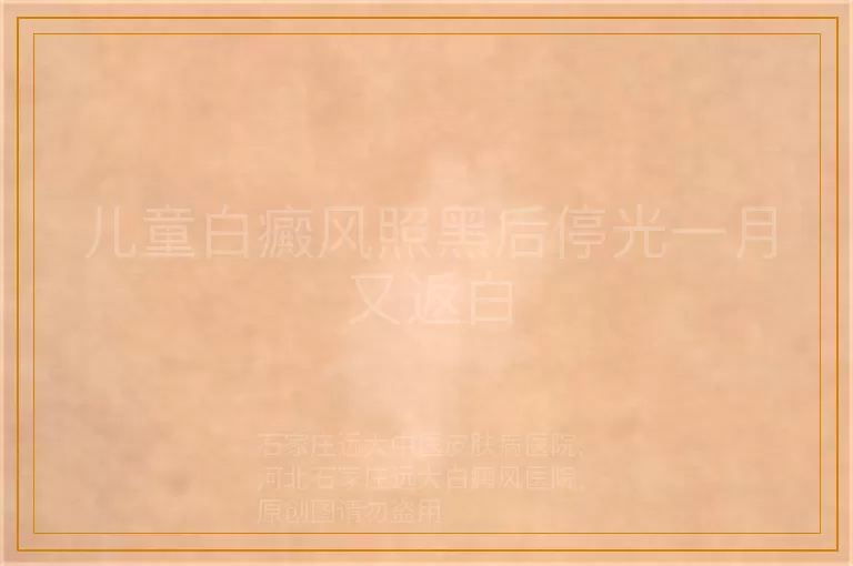 儿童白癜风照黑后停光一月又返白