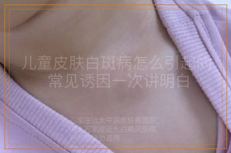 儿童皮肤白斑病怎么引起的 常见诱因一次讲明白