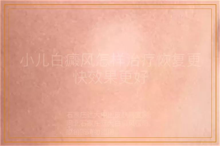 小儿白癜风怎样治疗恢复更快效果更好