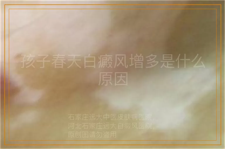 孩子春天白癜风增多是什么原因