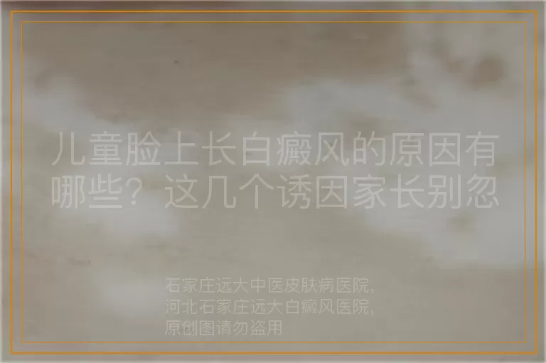儿童脸上长白癜风的原因有哪些？这几个诱因家长别忽略