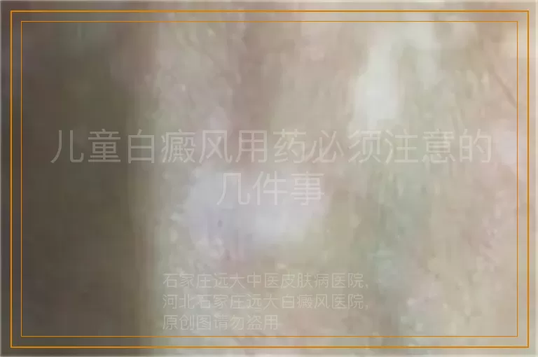 儿童白癜风用药必须注意的几件事