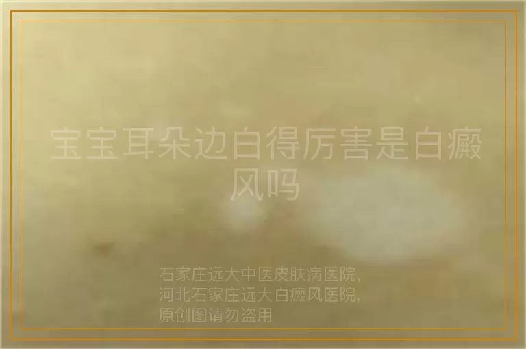宝宝耳朵边白得厉害是白癜风吗
