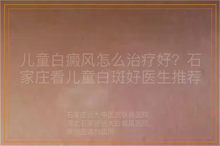 儿童白癜风怎么治疗好？石家庄看儿童白斑好医生推荐