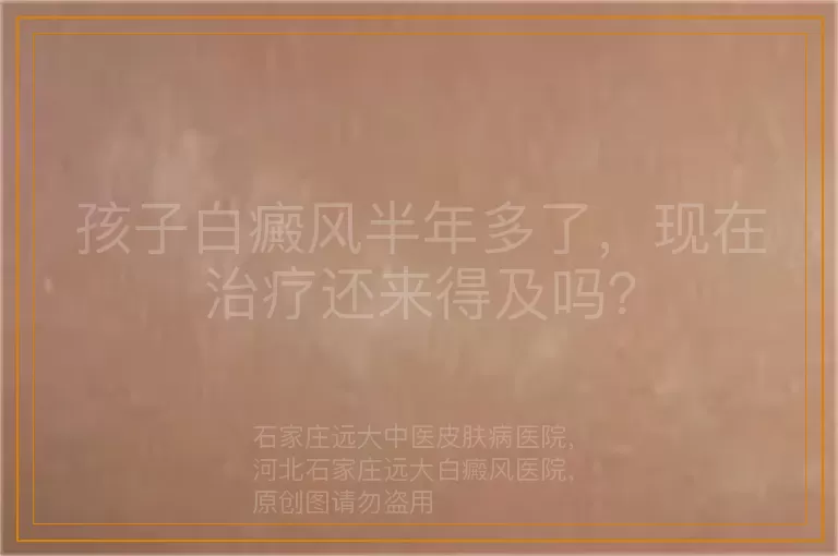 孩子白癜风半年多了，现在治疗还来得及吗？