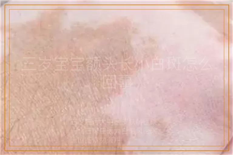 三岁宝宝额头长小白斑怎么回事