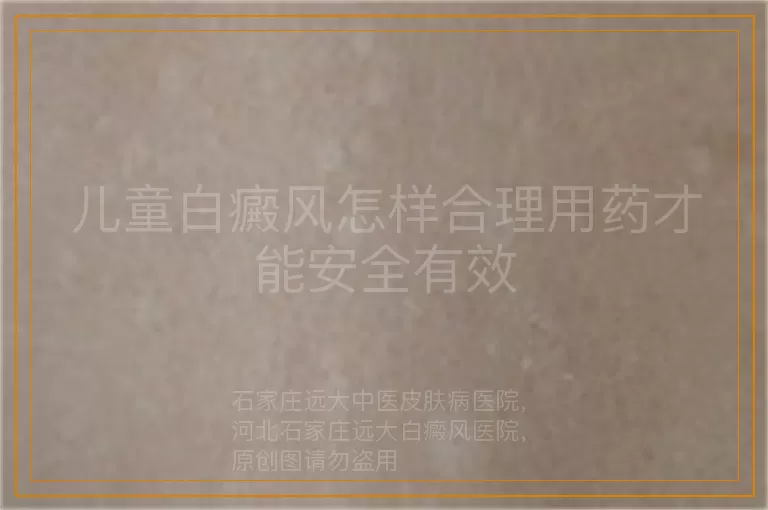 儿童白癜风怎样合理用药才能安全有效