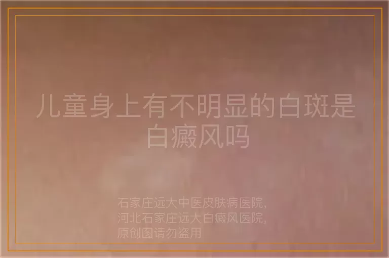 儿童身上有不明显的白斑是白癜风吗
