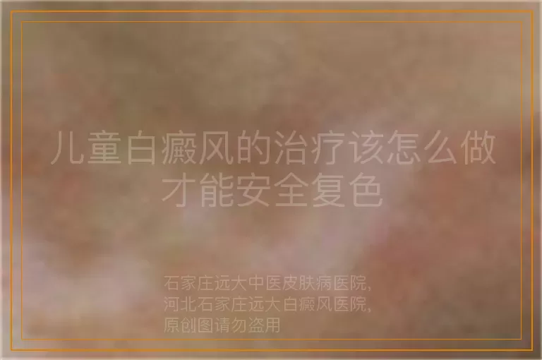 儿童白癜风的治疗该怎么做才能安全复色