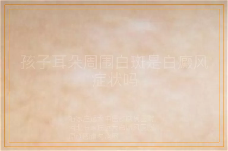 孩子耳朵周围白斑是白癜风症状吗