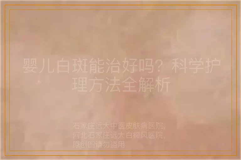 婴儿白斑能治好吗？科学护理方法全解析