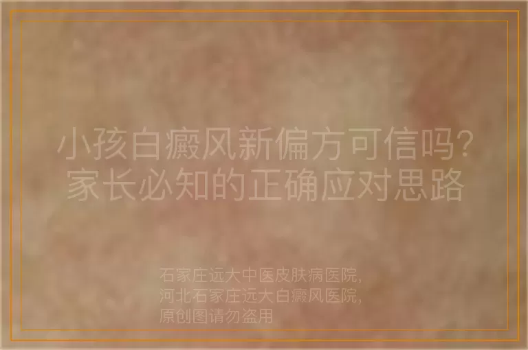 小孩白癜风新偏方可信吗？家长必知的正确应对思路
