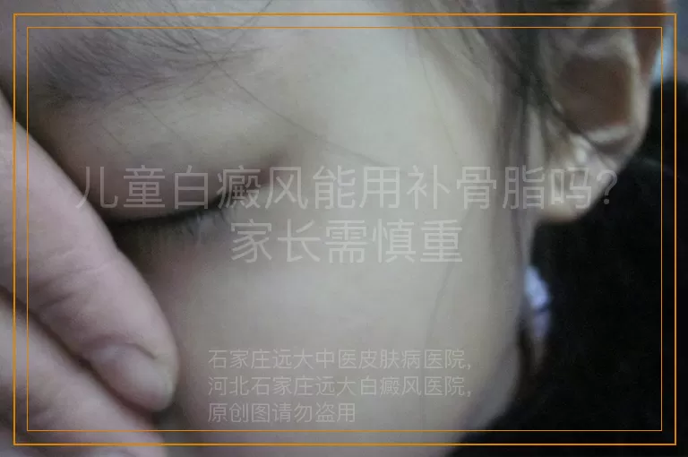 儿童白癜风能用补骨脂吗？家长需慎重