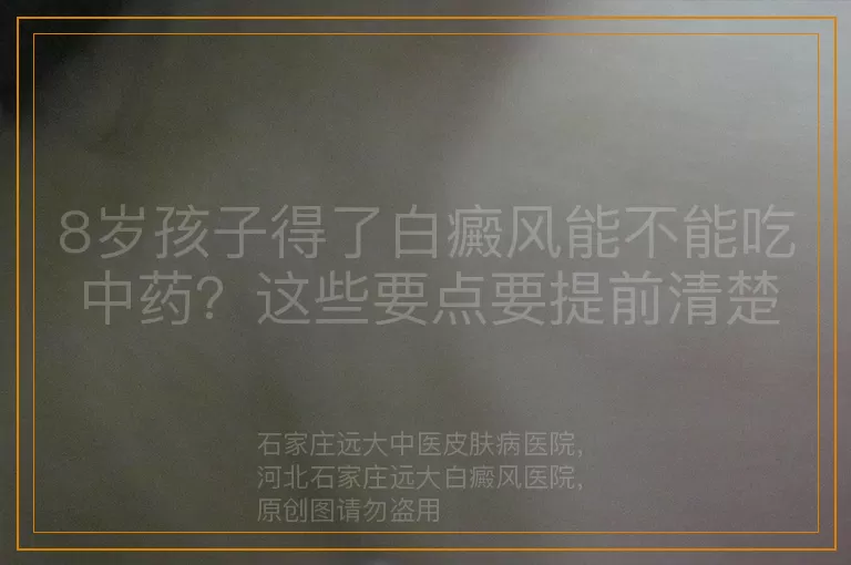 8岁孩子得了白癜风能不能吃中药？这些要点要提前清楚