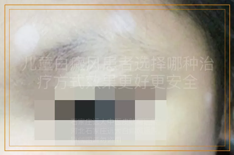 儿童白癜风患者选择哪种治疗方式效果更好更安全