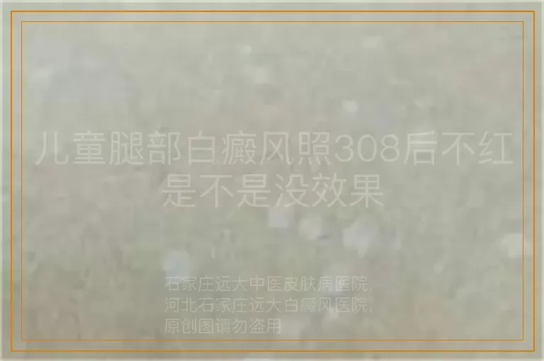 儿童腿部白癜风照308后不红是不是没效果
