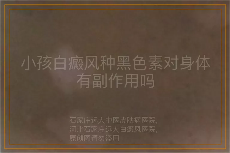 小孩白癜风种黑色素对身体有副作用吗