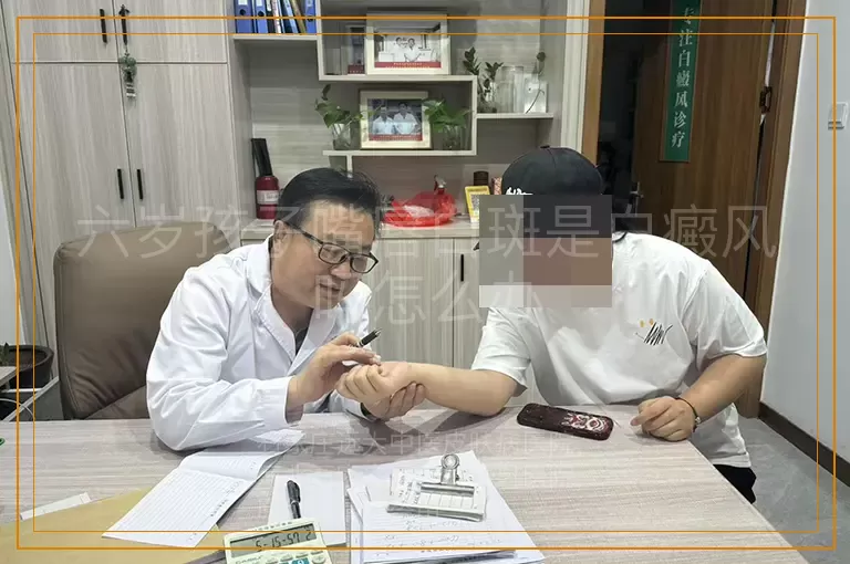 六岁孩子嘴唇白斑是白癜风吗怎么办