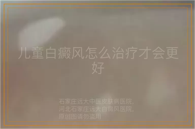 儿童白癜风怎么治疗才会更好