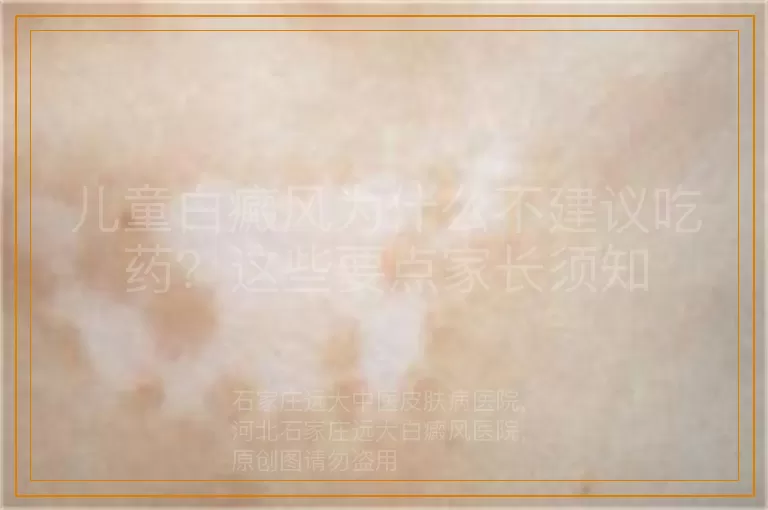儿童白癜风为什么不建议吃药？这些要点家长须知