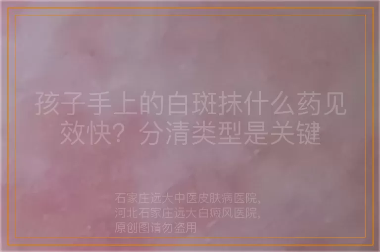孩子手上的白斑抹什么药见效快？分清类型是关键