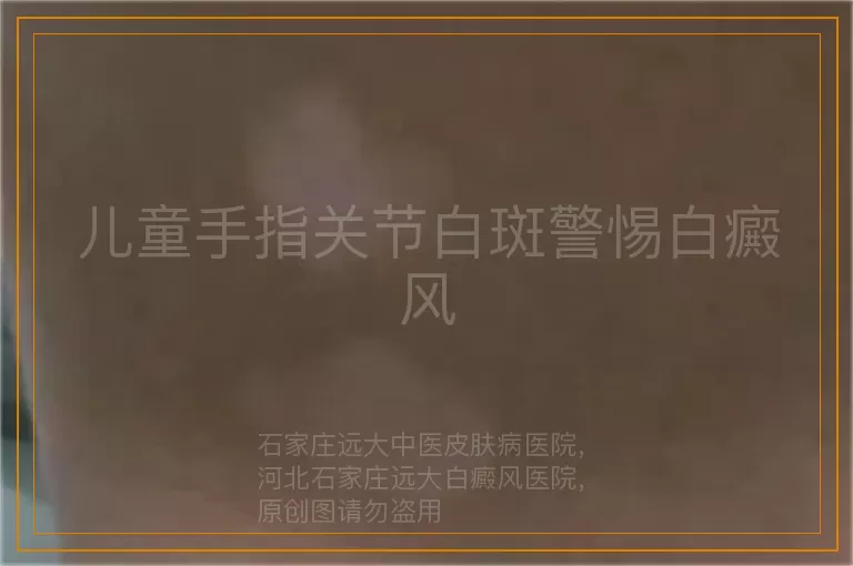 儿童手指关节白斑警惕白癜风