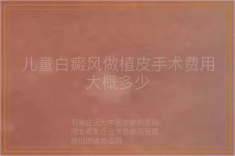 儿童白癜风做植皮手术费用大概多少