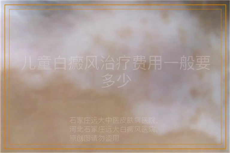 儿童白癜风治疗费用一般要多少