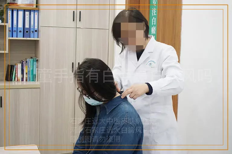 儿童手指有白点是白癜风吗
