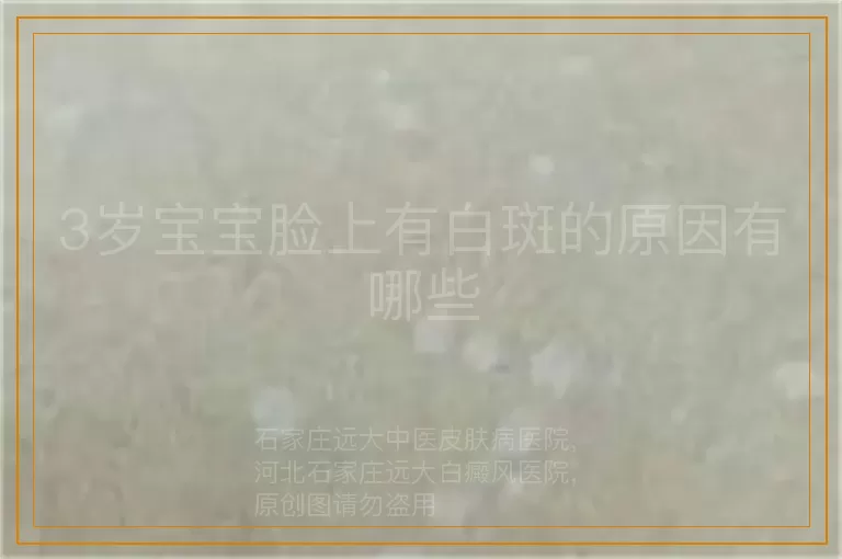 3岁宝宝脸上有白斑的原因有哪些