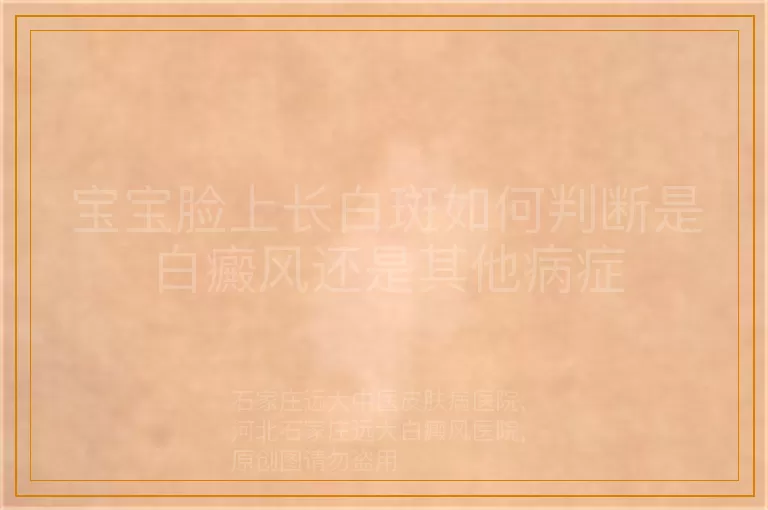 宝宝脸上长白斑如何判断是白癜风还是其他病症