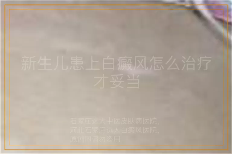 新生儿患上白癜风怎么治疗才妥当