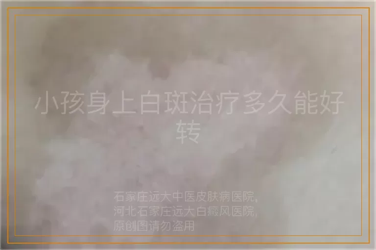小孩身上白斑治疗多久能好转
