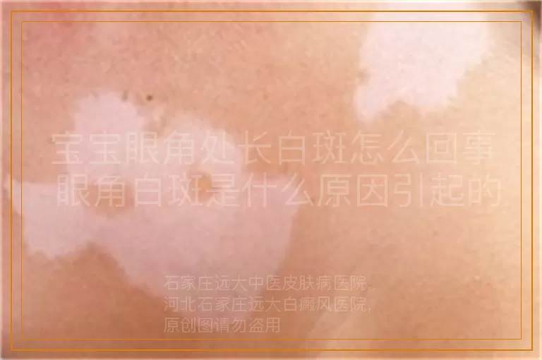 宝宝眼角处长白斑怎么回事 眼角白斑是什么原因引起的