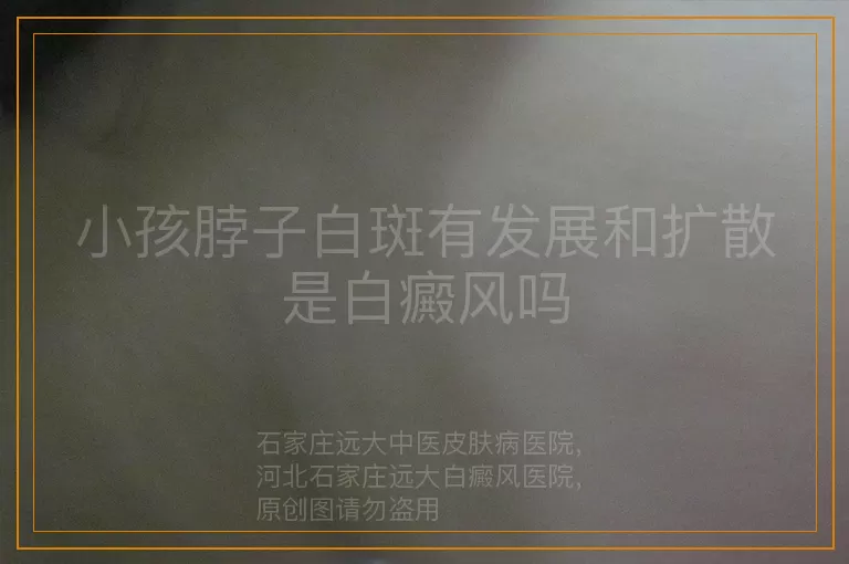 小孩脖子白斑有发展和扩散是白癜风吗